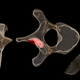 Tumors found on the vertebra of an Australopithecus sediba specimen are shown in pink. (Image: P. S. Randolph-Quinney et al., 2016)